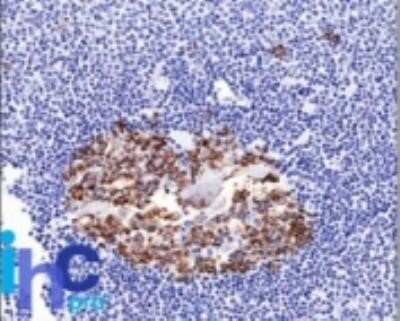 Immunohistochemistry-Paraffin: ST6 Gal Sialyltransferase 1/ST6GAL1/CD75 Antibody (LN-1) - Azide and BSA Free [NBP2-47890]