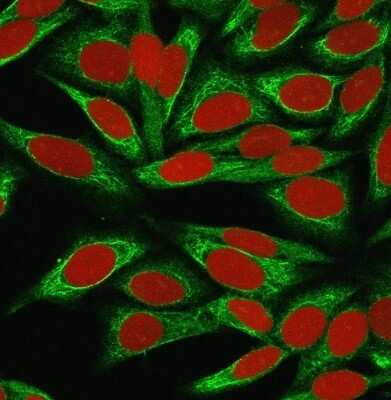 Immunocytochemistry/ Immunofluorescence: ST6 Gal Sialyltransferase 1/ST6GAL1/CD75 Antibody (LN-1) [NBP2-44669]