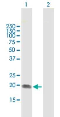 Western Blot: ST6 Gal Sialyltransferase 1/ST6GAL1/CD75 Antibody [H00006480-B01P]