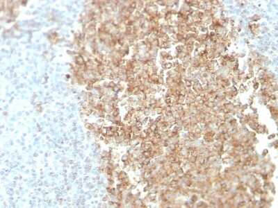 Immunohistochemistry-Paraffin: ST6 Gal Sialyltransferase 1/ST6GAL1/CD75 Antibody (ZB55) - Azide and BSA Free [NBP3-08436]