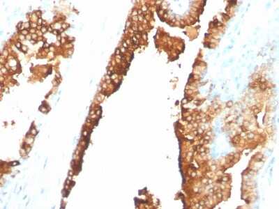 Immunohistochemistry-Paraffin: ST6 Gal Sialyltransferase 1/ST6GAL1/CD75 Antibody (ZB55) - Azide and BSA Free [NBP3-08436]