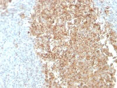 Immunohistochemistry-Paraffin: ST6 Gal Sialyltransferase 1/ST6GAL1/CD75 Antibody (ZB55) [NBP3-07770]