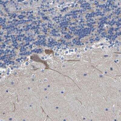 Immunohistochemistry-Paraffin: ST6 Gal Sialyltransferase 2/ST6GAL2 Antibody [NBP1-81364]