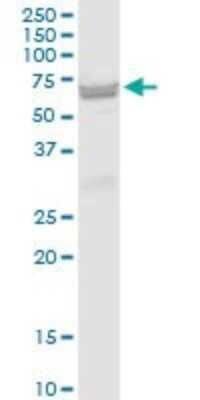 Western Blot: ST6 Gal Sialyltransferase 2/ST6GAL2 Antibody [H00084620-B01P]