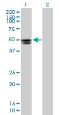 Western Blot: ST6 Gal Sialyltransferase 2/ST6GAL2 Antibody [H00084620-B01P]
