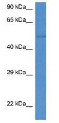 Western Blot: ST6 Gal Sialyltransferase 2/ST6GAL2 Antibody [NBP1-74154]