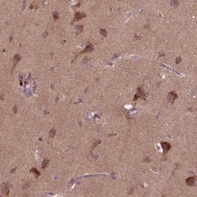 Immunohistochemistry: ST6 GalNAc alpha-2,6-sialyltransferaseV/ST6GALNAC5 Antibody [NBP2-49632]