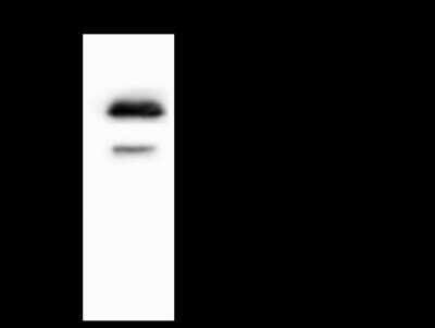 Immunoprecipitation: ST6 GalNAc alpha-2,6-sialyltransferaseV/ST6GALNAC5 Antibody [NBP2-98479]