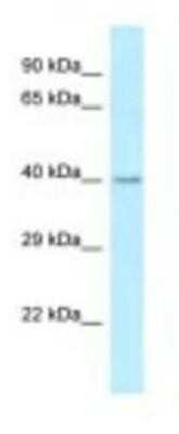 Western Blot: ST6 Sialyltransferase 2/ST6GALNAC2 Antibody [NBP1-98415]