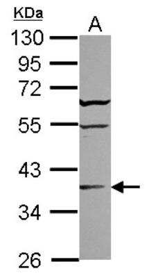 Western Blot: ST6 Sialyltransferase 2/ST6GALNAC2 Antibody [NBP2-20494]