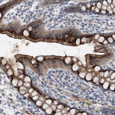 Immunohistochemistry-Paraffin: ST6 Sialyltransferase 6/ST6GALNAC6 Antibody [NBP1-80751]