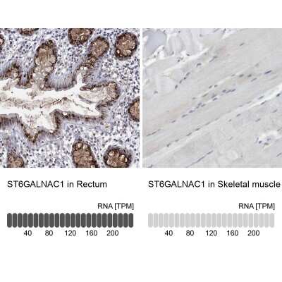 Immunohistochemistry-Paraffin: ST6GALNAC1 Antibody [NBP1-87043]