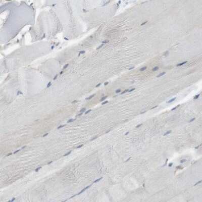 Immunohistochemistry-Paraffin: ST6GALNAC1 Antibody [NBP1-87043]