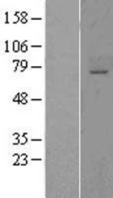 Western Blot: ST6GALNAC1 Overexpression Lysate [NBL1-16498]