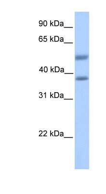 Western Blot: ST6 Sialyltransferase 2/ST6GALNAC2 Antibody [NBP1-62623]