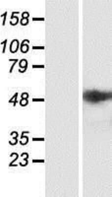 Western Blot: ST6 Sialyltransferase 2/ST6GALNAC2 Overexpression Lysate [NBP2-07618]