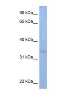 Western Blot: ST6GALNAC3 Antibody [NBP1-69326]