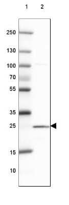 Western Blot: ST6GALNAC3 Antibody [NBP2-31603]