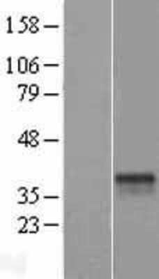 Western Blot: ST6GALNAC3 Overexpression Lysate [NBL1-16500]