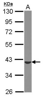 Western Blot: ST6GALNAC4 Antibody [NBP2-20495]