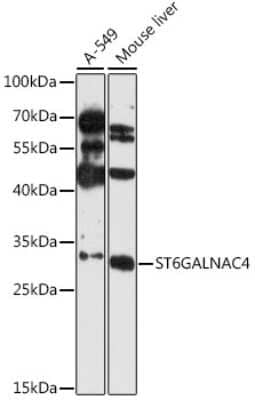 Western Blot: ST6GALNAC4 AntibodyAzide and BSA Free [NBP2-93510]