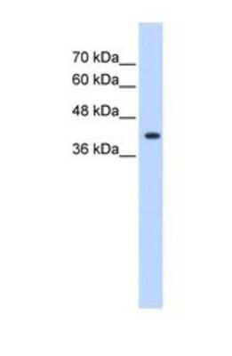 Western Blot: ST6 GalNAc alpha-2,6-sialyltransferaseV/ST6GALNAC5 Antibody [NBP1-69618]