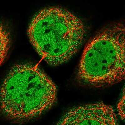 Immunocytochemistry/ Immunofluorescence: Suppression of Tumorigenicity 7 Antibody [NBP1-84772]