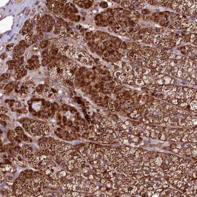 Immunohistochemistry-Paraffin: Suppression of Tumorigenicity 7 Antibody [NBP1-84772]
