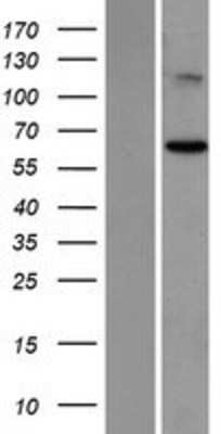 Western Blot: Suppression of Tumorigenicity 7 Overexpression Lysate [NBP2-06804]