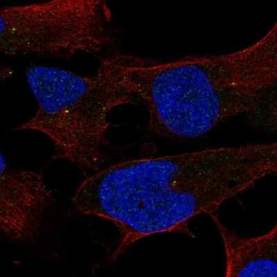 Immunocytochemistry/ Immunofluorescence: ST7L Antibody [NBP2-57982]