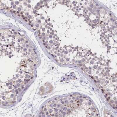 Immunohistochemistry-Paraffin: ST7L Antibody [NBP1-83926]