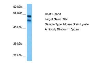 Western Blot: ST7L Antibody [NBP2-85834]