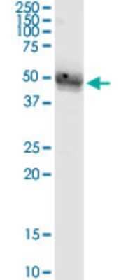 Western Blot: ST8 alpha-2,8-Sialyltransferase 4/ST8SIA4 Antibody (1H5) [H00007903-M03]