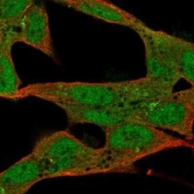 Immunocytochemistry/ Immunofluorescence: ST8 alpha-2,8-Sialyltransferase 8B/ST8SIA2 Antibody [NBP3-17939]