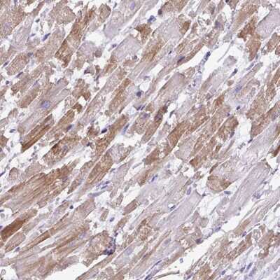 Immunohistochemistry-Paraffin: ST8 alpha-2,8-Sialyltransferase 8B/ST8SIA2 Antibody [NBP2-33719]