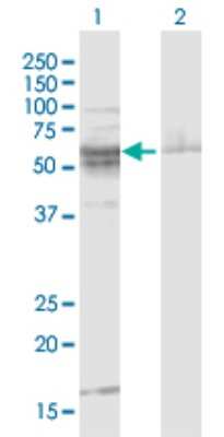 Western Blot: ST8 alpha-2,8-Sialyltransferase 8B/ST8SIA2 Antibody [H00008128-D01P]