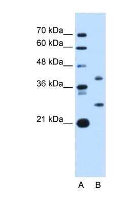 Western Blot: ST8 alpha-2,8-Sialyltransferase 8B/ST8SIA2 Antibody [NBP1-69280]