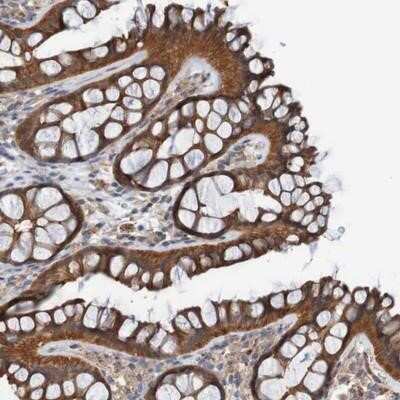 Immunohistochemistry-Paraffin: ST8SIA-VI Antibody [NBP1-87042]