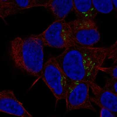 Immunocytochemistry/ Immunofluorescence: ST8SIA3 Antibody [NBP2-56457]