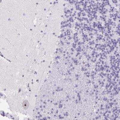 Immunohistochemistry-Paraffin: ST8SIA3 Antibody [NBP2-38027]