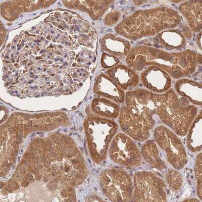 Immunohistochemistry-Paraffin: ST8 alpha-2,8-Sialyltransferase 4/ST8SIA4 Antibody [NBP2-13393]