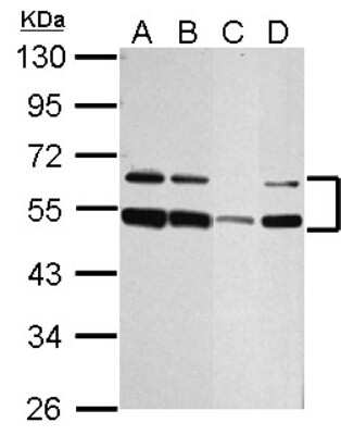 Western Blot: ST8 alpha-2,8-Sialyltransferase 4/ST8SIA4 Antibody [NBP2-20497]