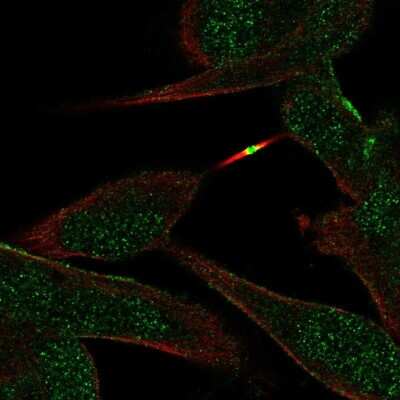 Immunocytochemistry/ Immunofluorescence: ST8SIA5 Antibody [NBP2-30530]