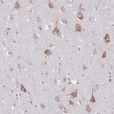Immunohistochemistry-Paraffin: ST8SIA5 Antibody [NBP2-30530]