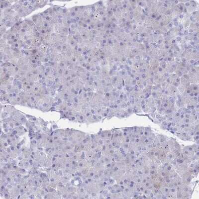 Immunohistochemistry-Paraffin: ST8SIA5 Antibody [NBP2-30530]
