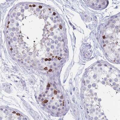 Immunohistochemistry-Paraffin: ST8SIA5 Antibody [NBP2-30530]