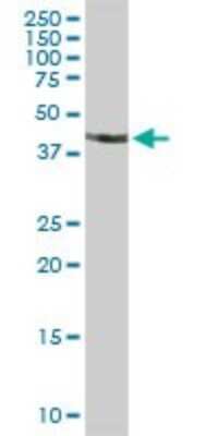 Western Blot: STAC Antibody [H00006769-D01P]
