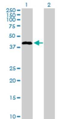 Western Blot: STAC Antibody [H00006769-D01P]