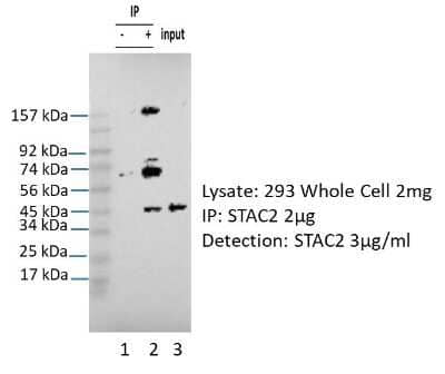 Western Blot: STAC2 Antibody [NBP3-09669]