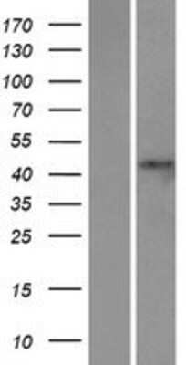 Western Blot: STAC2 Overexpression Lysate [NBP2-04658]